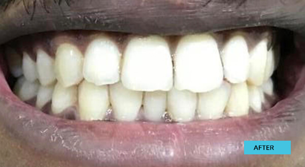 Before & After