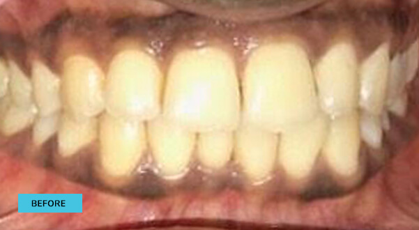Before & After