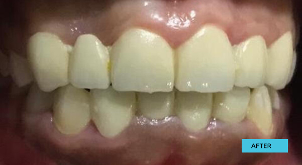 Before & After