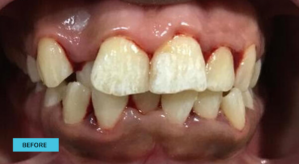 Before & After