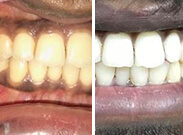 Before & After