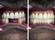 Before & After