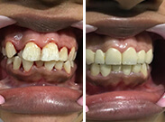 Before & After