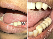 Before & After