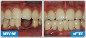 best dentist in chennai