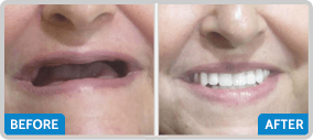 good dentist in chennai